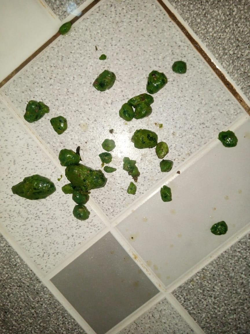 Gallbladder stones on bathroom tile