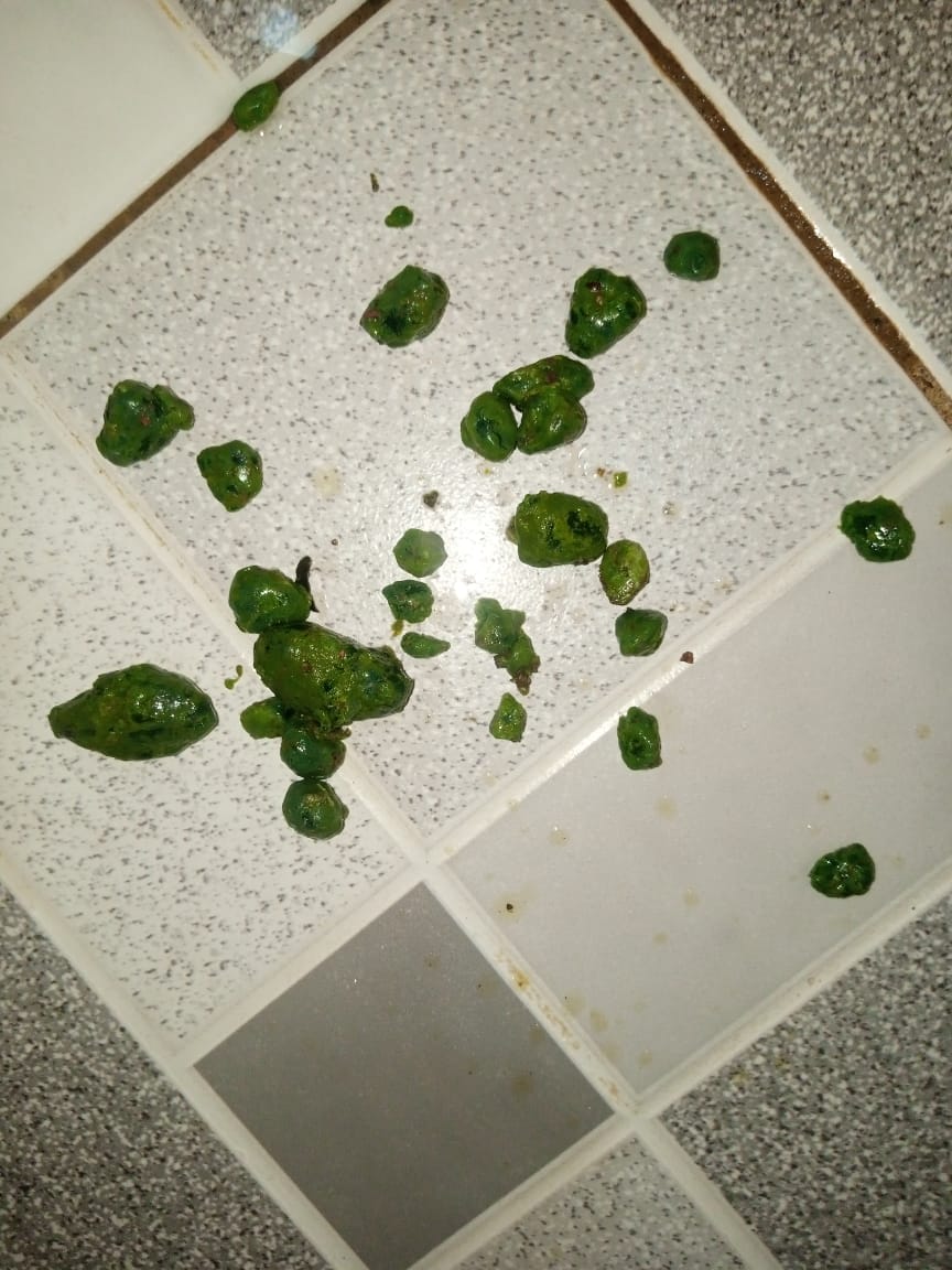 More gallbladder stones on bathroom tile