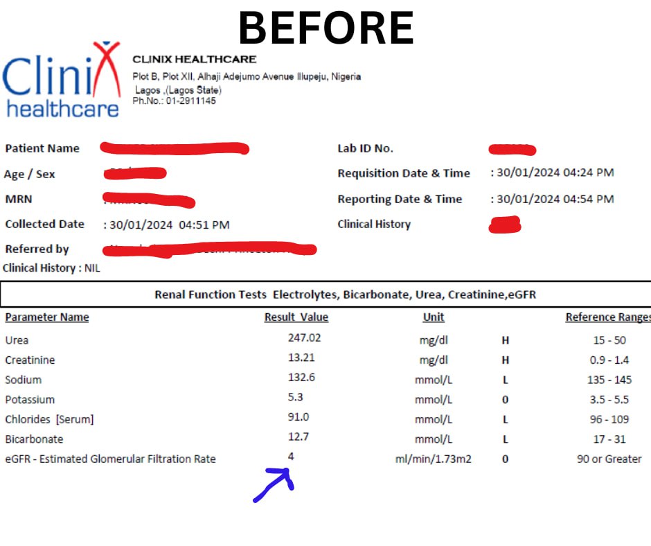 Before — eGFR 4, kidney failure