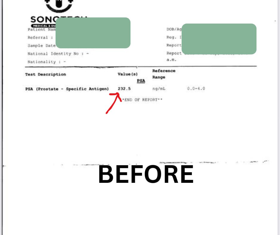 Before — PSA 232.5 ng/mL