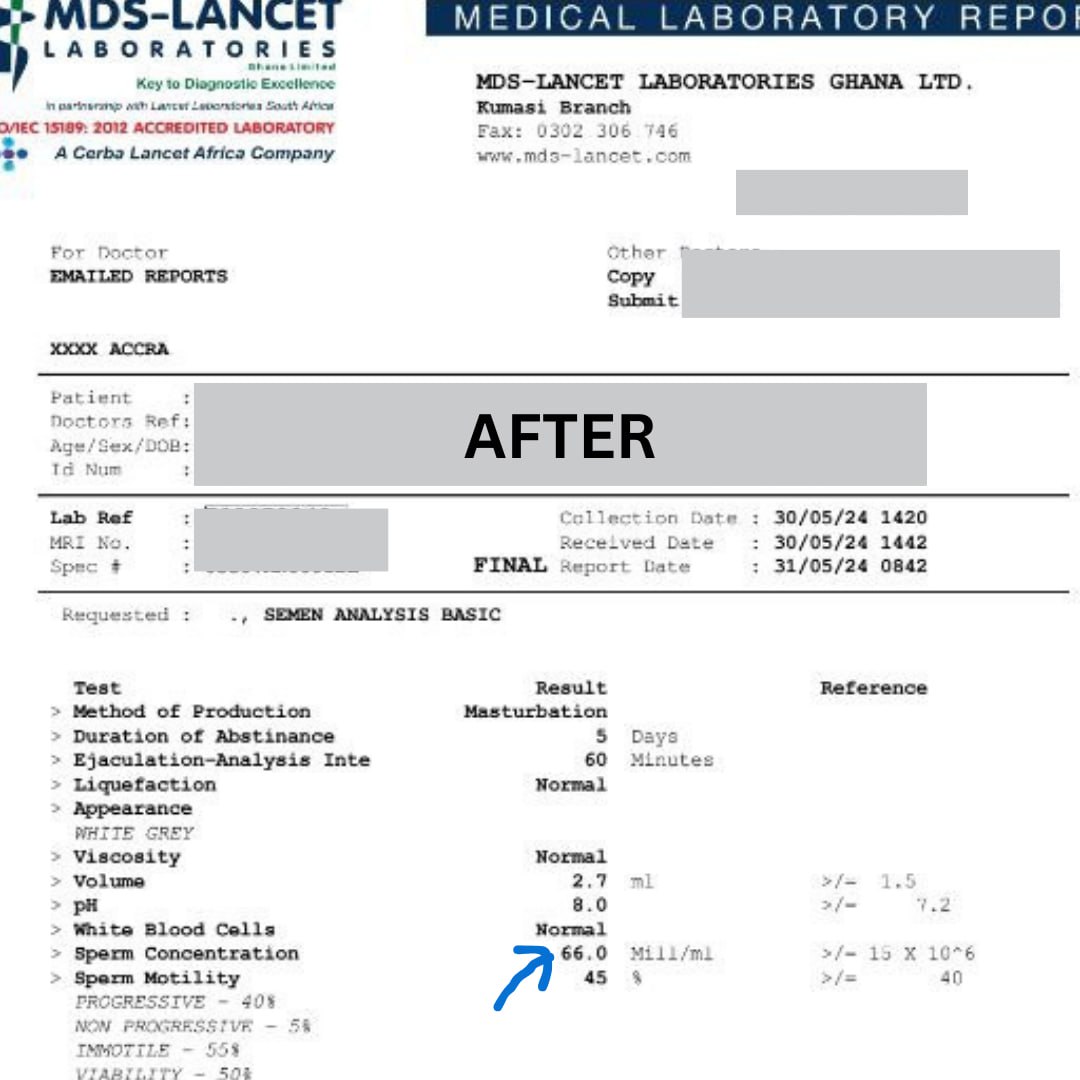 After — Normal sperm count analysis