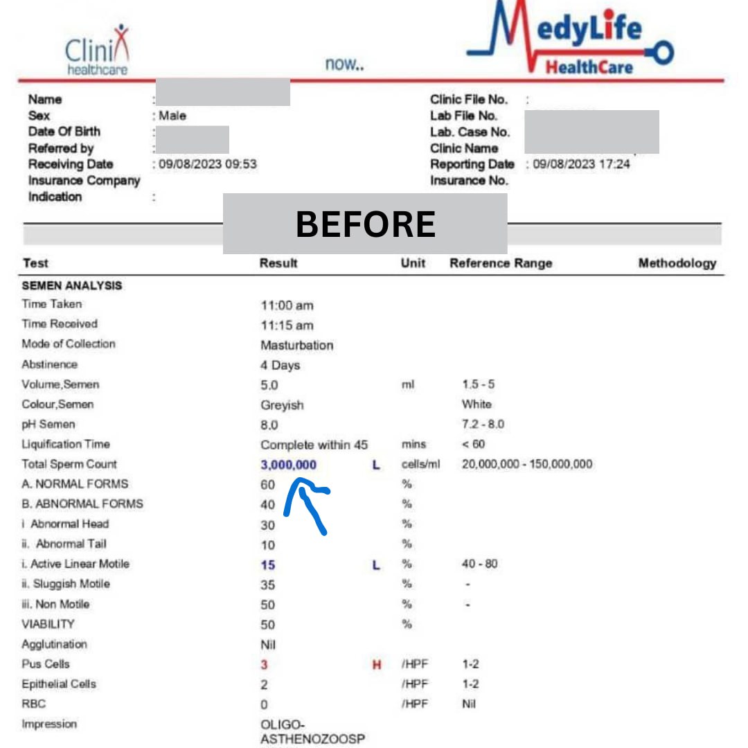 Before — Low sperm count analysis